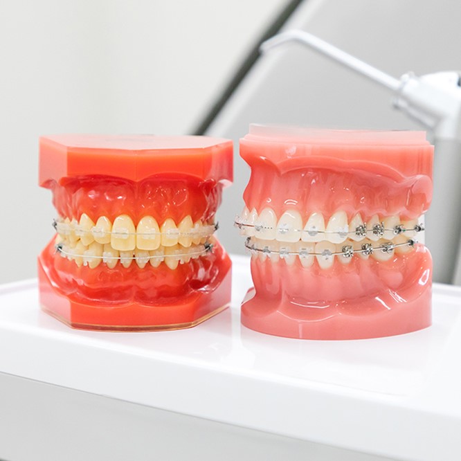 当院の成人矯正