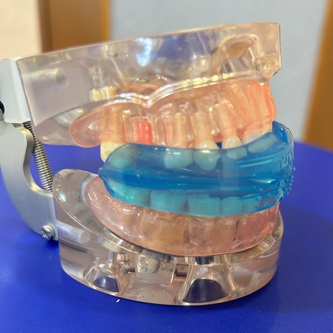 当院の小児矯正